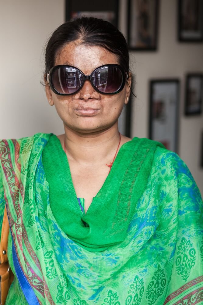 India’s Acid Attack Victims Are Helping Each Other Thrive