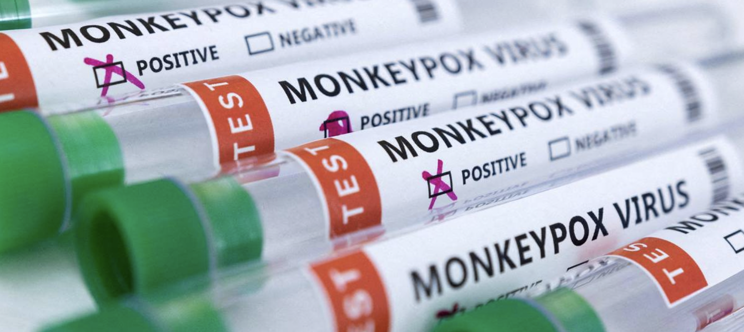 Europe's Monkeypox Outbreak Sparks Fears of Anti-LGBTQ+ Backlash - Vimarsana News