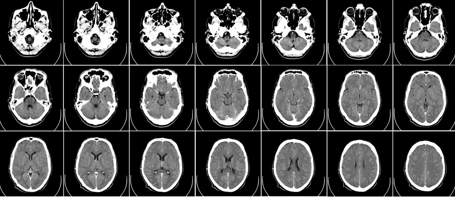 This Is Your Brain On Poverty With >> This Is Your Brain On Poverty 5 Facts This Is Your Brain On Poverty With >> This Is Your Brain On Poverty 5 Facts